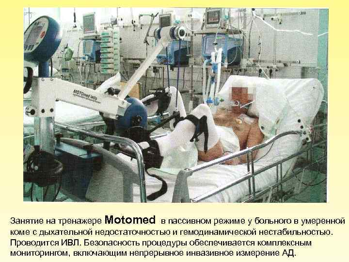 Занятие на тренажере Motomed в пассивном режиме у больного в умеренной коме с дыхательной