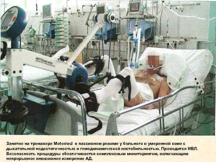 Занятие на тренажере Motomed в пассивном режиме у больного в умеренной коме с дыхательной