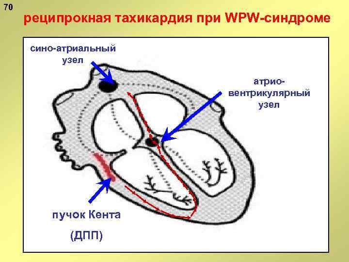 Атриальная полость