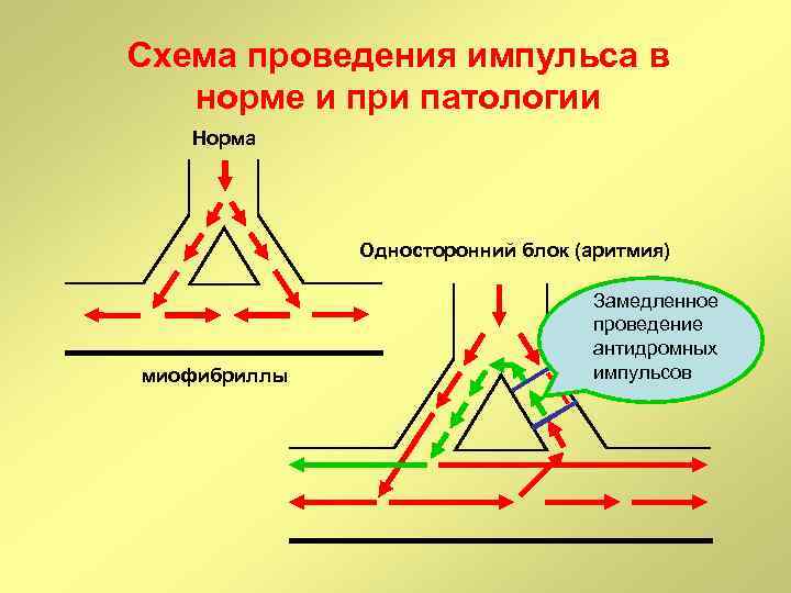 Проведение импульса. Схема распределения импульсов. Распространение импульса в АВ-соединении в норме. Распространение импульса в атриовентрикулярного соединения в норме. Блок проведения импульса.