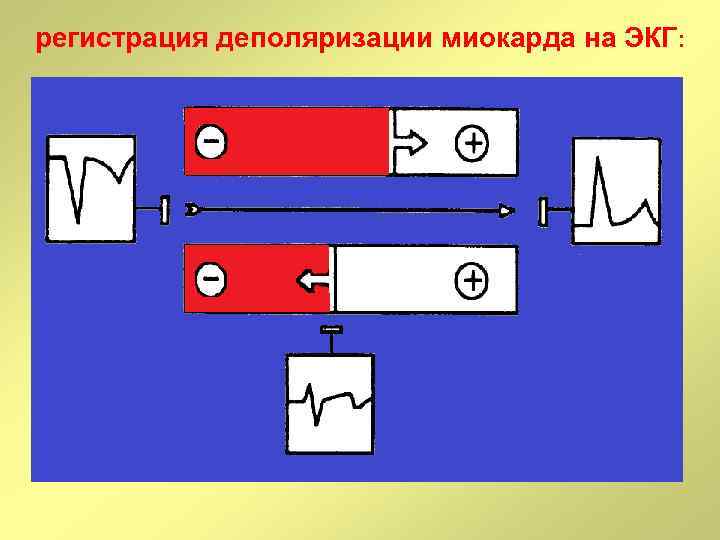 регистрация деполяризации миокарда на ЭКГ: 