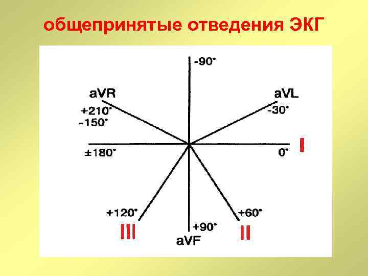 общепринятые отведения ЭКГ 