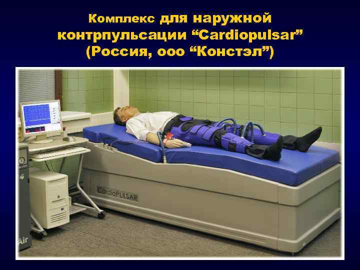 Комплекс для наружной контрпульсации “Cardiopulsar” (Россия, ооо “Констэл”) 