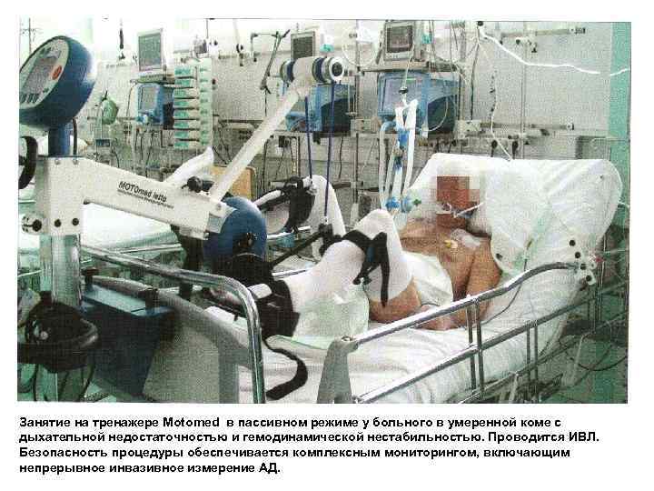 Занятие на тренажере Motomed в пассивном режиме у больного в умеренной коме с дыхательной
