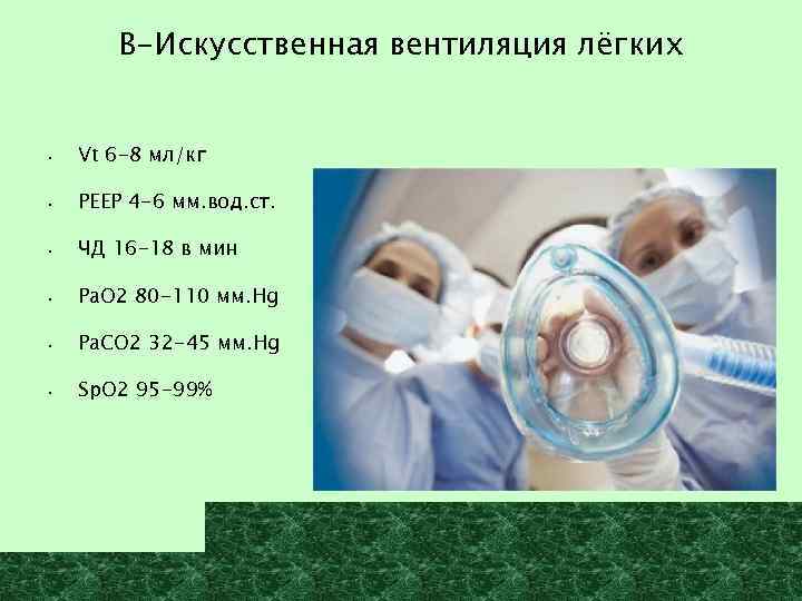 В-Искусственная вентиляция лёгких • Vt 6 -8 мл/кг • РЕЕР 4 -6 мм. вод.