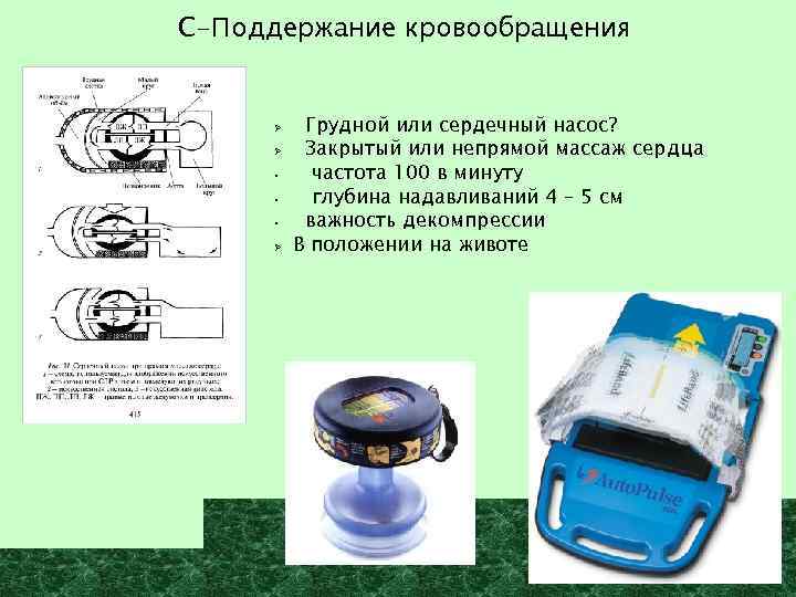 С-Поддержание кровообращения Ø Ø • • • Ø Грудной или сердечный насос? Закрытый или