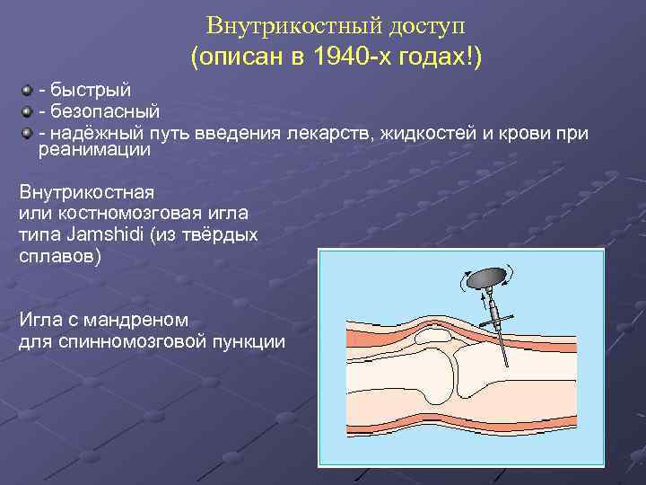 Внутрикостный доступ (описан в 1940 -х годах!) - быстрый - безопасный - надёжный путь