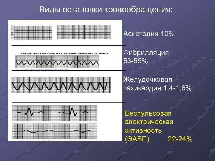 Виды остановки кровообращения: Асистолия 10% Фибрилляция 53 -55% Желудочковая тахикардия 1, 4 -1, 6%