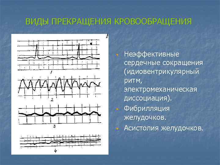 ВИДЫ ПРЕКРАЩЕНИЯ КРОВООБРАЩЕНИЯ w w w Неэффективные сердечные сокращения (идиовентрикулярный ритм, электромеханическая диссоциация). Фибрилляция