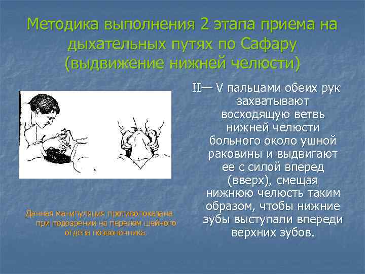 Методика выполнения 2 этапа приема на дыхательных путях по Сафару (выдвижение нижней челюсти) Данная