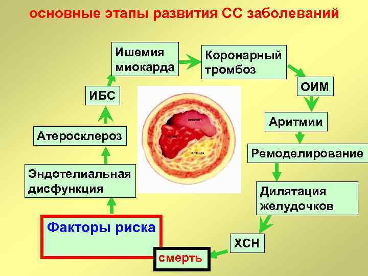 основные этапы развития СС заболеваний Ишемия миокарда Коронарный тромбоз ОИМ ИБС Аритмии Атеросклероз Ремоделирование