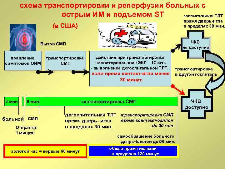 схема транспортировки и реперфузии больных с острым ИМ и подъемом ST госпитальная ТЛТ время