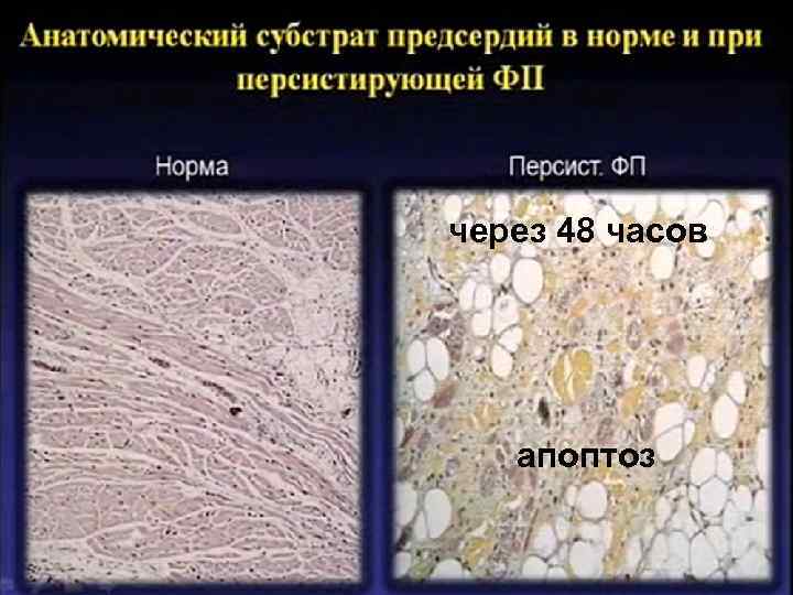 через 48 часов апоптоз 