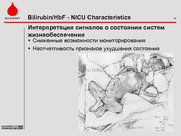 RED SYSTEM™ Bilirubin/Hb. F - NICU Characteristics Интерпретация сигналов о состоянии систем жизнеобеспечения •