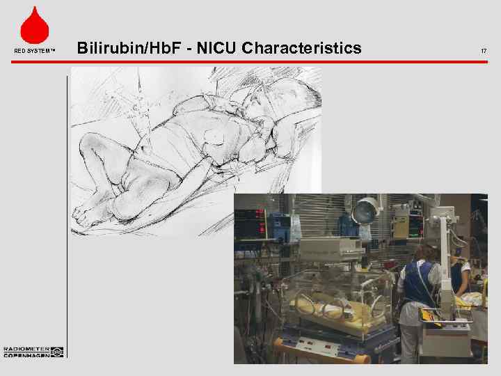RED SYSTEM™ Bilirubin/Hb. F - NICU Characteristics 17 