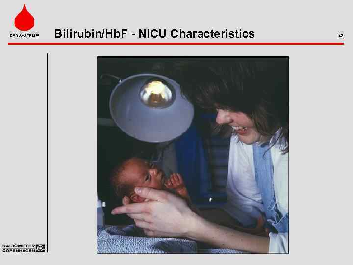 RED SYSTEM™ Bilirubin/Hb. F - NICU Characteristics 42 