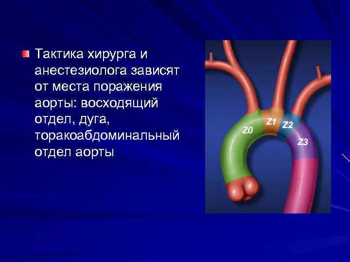 Тактика хирурга и анестезиолога зависят от места поражения аорты: восходящий отдел, дуга, торакоабдоминальный отдел