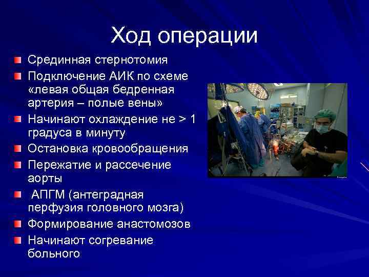 Ход операции Срединная стернотомия Подключение АИК по схеме «левая общая бедренная артерия – полые