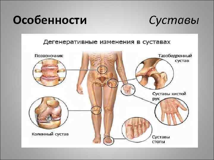 Особенности Суставы 