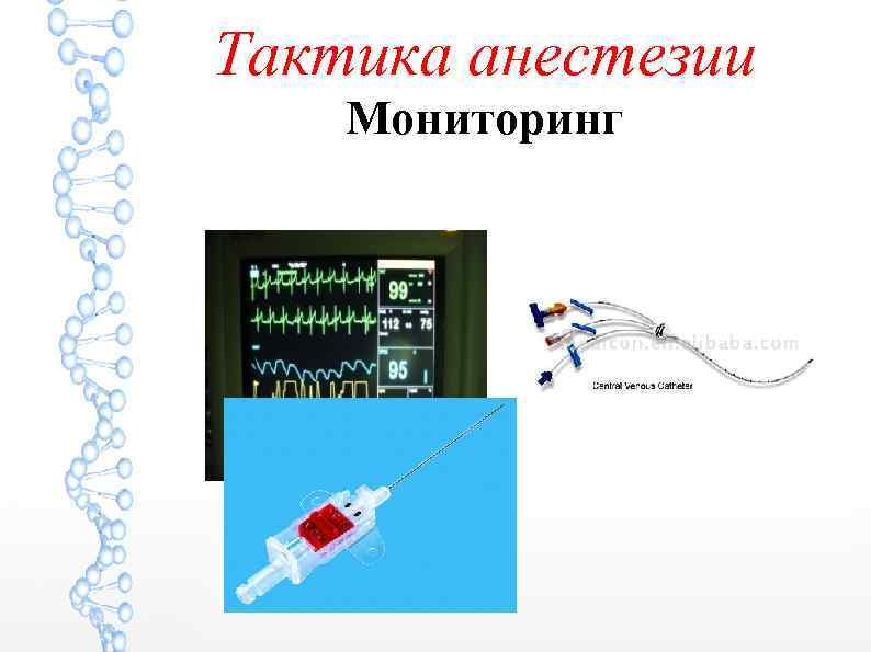 Тактика анестезии Мониторинг 