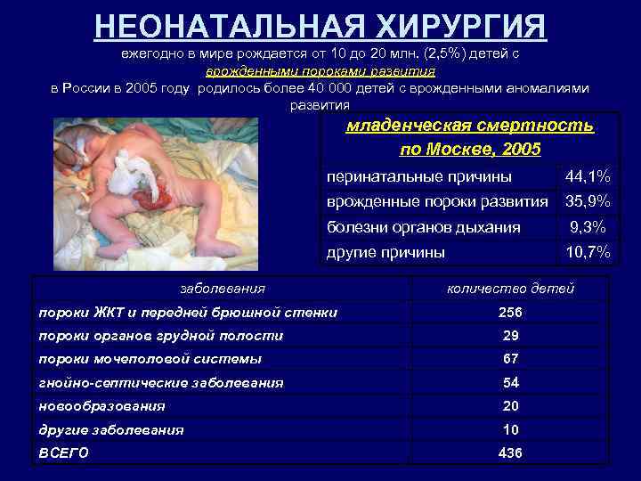НЕОНАТАЛЬНАЯ ХИРУРГИЯ ежегодно в мире рождается от 10 до 20 млн. (2, 5%) детей