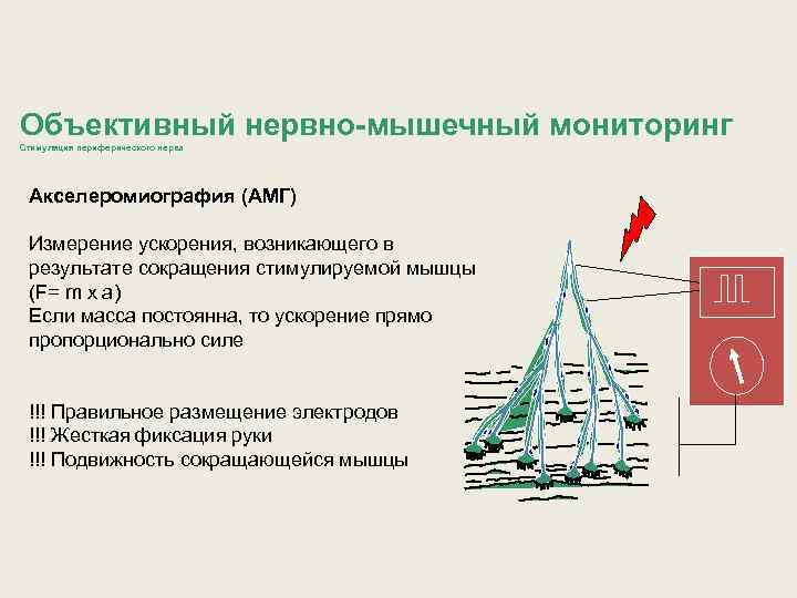 Объективный нервно-мышечный мониторинг Стимуляция периферического нерва Акселеромиография (АМГ) Измерение ускорения, возникающего в результате сокращения