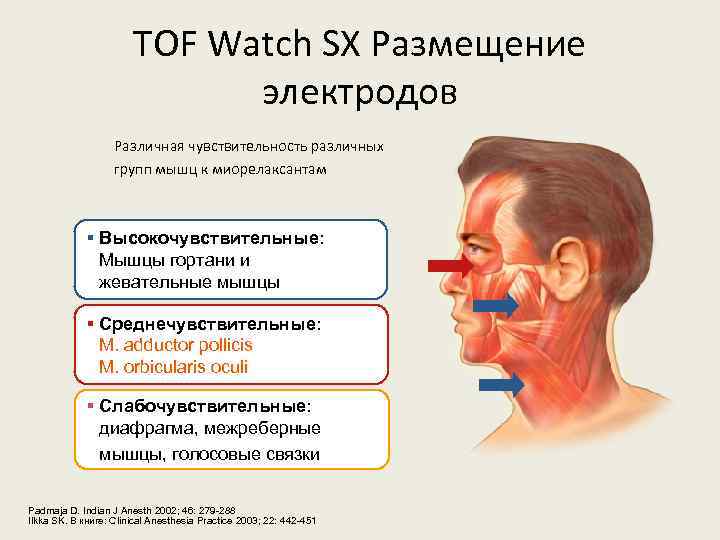 TOF Watch SX Размещение электродов Различная чувствительность различных групп мышц к миорелаксантам § Высокочувствительные: