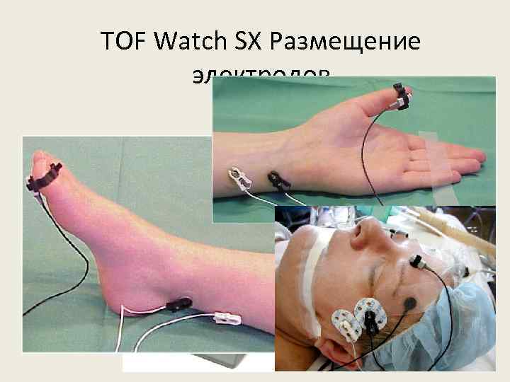 TOF Watch SX Размещение электродов TOF-Watch 