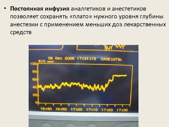  • Постоянная инфузия аналгетиков и анестетиков позволяет сохранять «плато» нужного уровня глубины анестезии