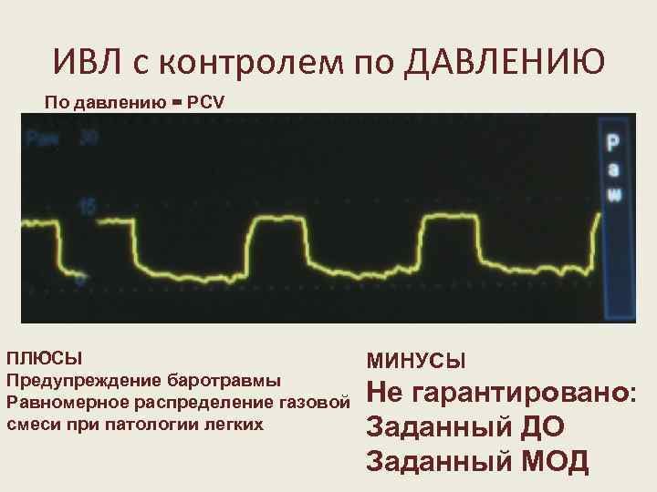 ИВЛ с контролем по ДАВЛЕНИЮ По давлению = РCV ПЛЮСЫ Предупреждение баротравмы Равномерное распределение