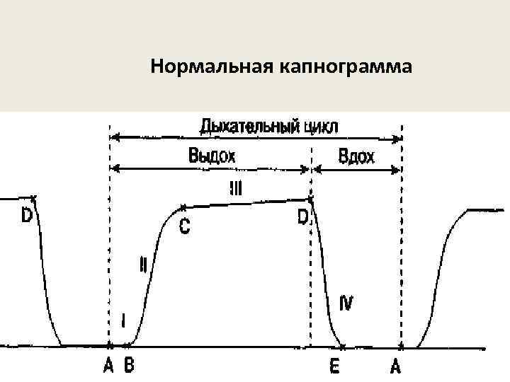 Нормальная капнограмма 