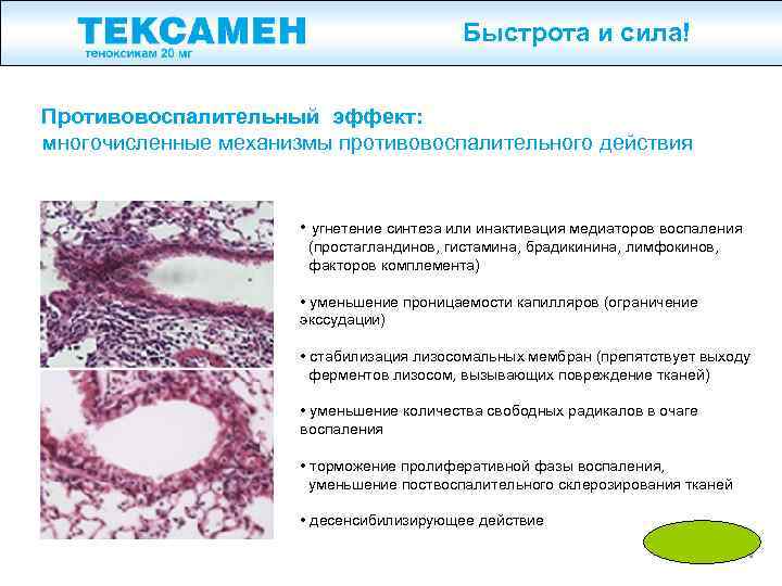 Быстрота и сила! Противовоспалительный эффект: многочисленные механизмы противовоспалительного действия • угнетение синтеза или инактивация