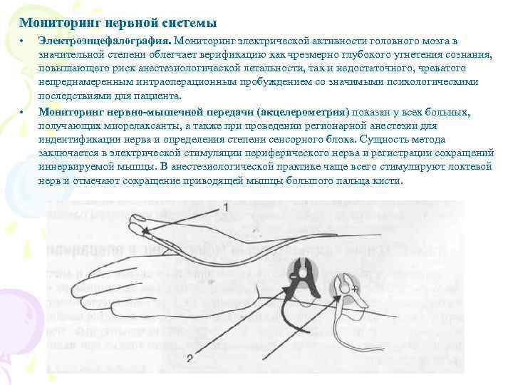 Мониторинг нервной системы • • Электроэнцефалография. Мониторинг электрической активности головного мозга в значительной степени