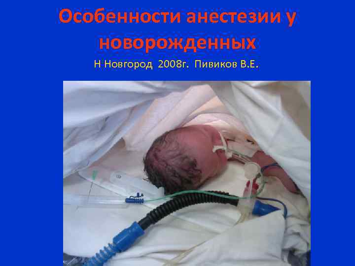 Особенности анестезии у новорожденных Н Новгород 2008 г. Пивиков В. Е. 