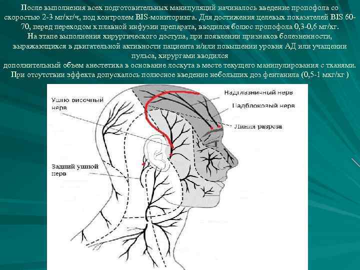 После выполнения всех подготовительных манипуляций начиналось введение пропофола со скоростью 2 -3 мг/кг/ч, под