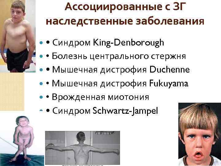 Ассоциированные с ЗГ наследственные заболевания • Синдром King-Denborough Болезнь центрального стержня • Мышечная дистрофия