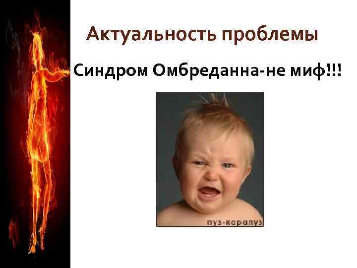 Актуальность проблемы Синдром Омбреданна-не миф!!! 