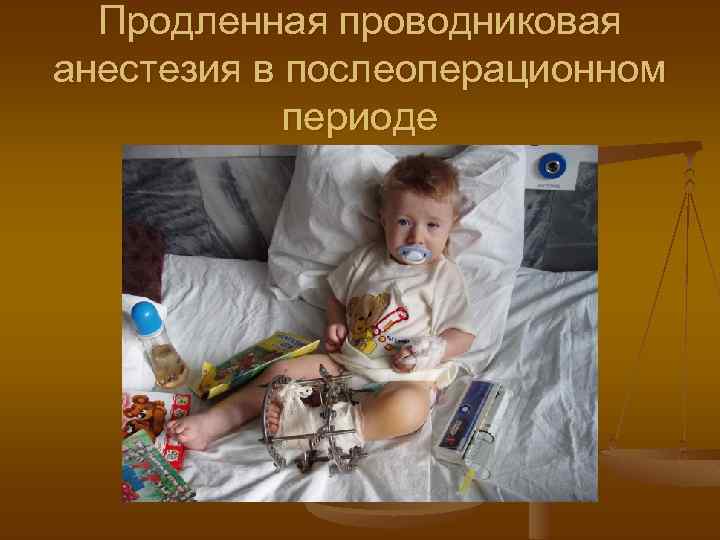 Продленная проводниковая анестезия в послеоперационном периоде 