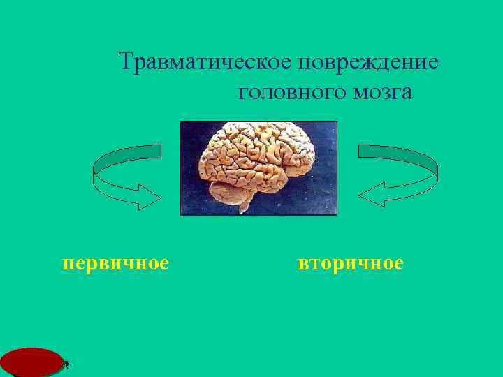 Травматическое повреждение головного мозга первичное MSD вторичное 