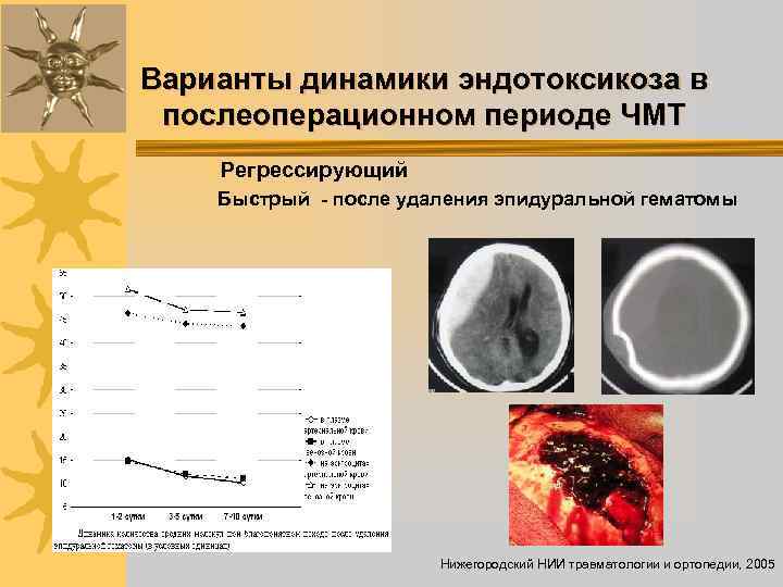 Варианты динамики эндотоксикоза в послеоперационном периоде ЧМТ Регрессирующий Быстрый - после удаления эпидуральной гематомы