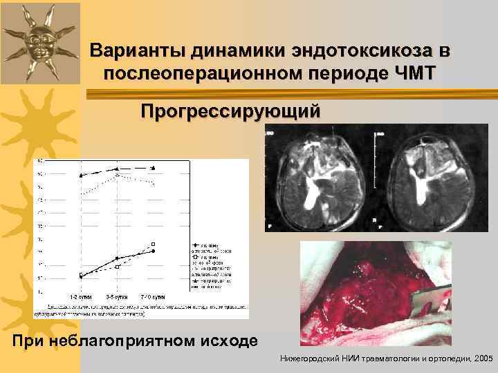 Варианты динамики эндотоксикоза в послеоперационном периоде ЧМТ Прогрессирующий При неблагоприятном исходе Нижегородский НИИ травматологии