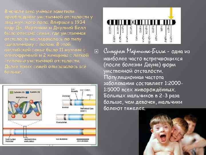 В начале века учёные заметили преобладание умственной отсталости у лиц мужского пола. Впервые в