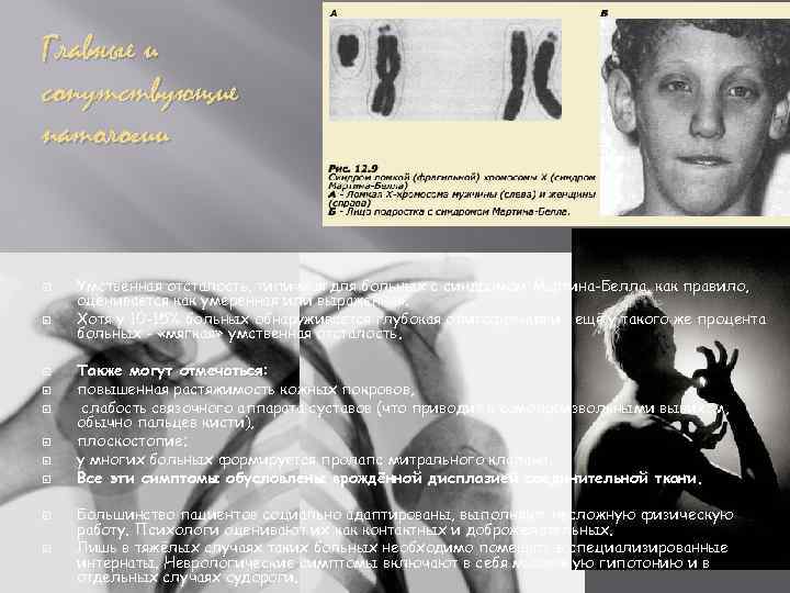 Главные и сопутствующие патологии Умственная отсталость, типичная для больных с синдромом Мартина-Белла, как правило,