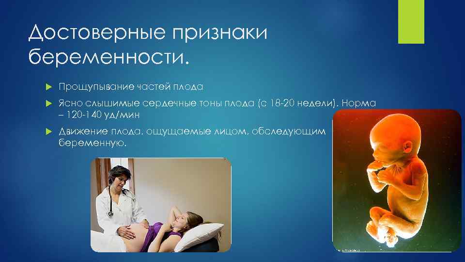 Достоверные признаки беременности. Прощупывание частей плода Ясно слышимые сердечные тоны плода (с 18 20