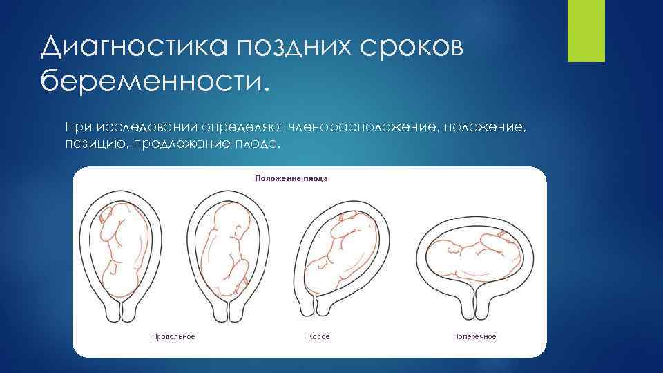 Диагностика поздних сроков беременности. При исследовании определяют членорасположение, позицию, предлежание плода. 