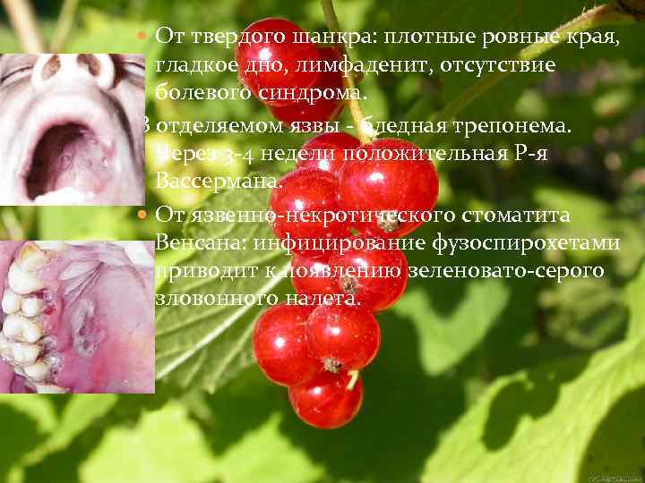  От твердого шанкра: плотные ровные края, гладкое дно, лимфаденит, отсутствие болевого синдрома. В