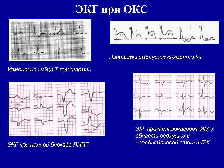 Варианты окс