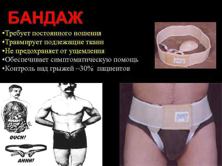 БАНДАЖ • Требует постоянного ношения • Травмирует подлежащие ткани • Не предохраняет от ущемления