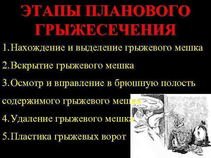 ЭТАПЫ ПЛАНОВОГО ГРЫЖЕСЕЧЕНИЯ 1. Нахождение и выделение грыжевого мешка 2. Вскрытие грыжевого мешка 3.