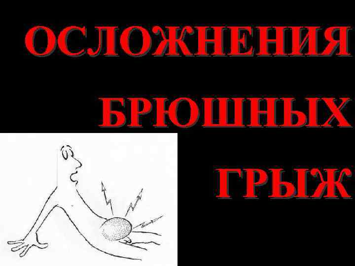 ОСЛОЖНЕНИЯ БРЮШНЫХ ГРЫЖ 